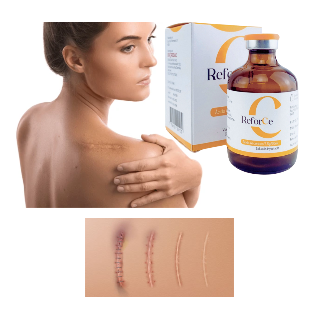 Vitamina C Reforce